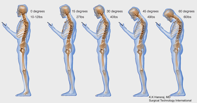 neck-pain-smartphone-hansrajkk-image